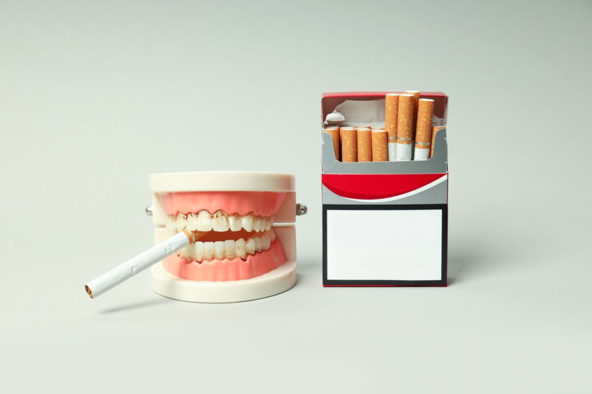 Smoking and Oral Health: How Tobacco Damages Your Gums and Teeth