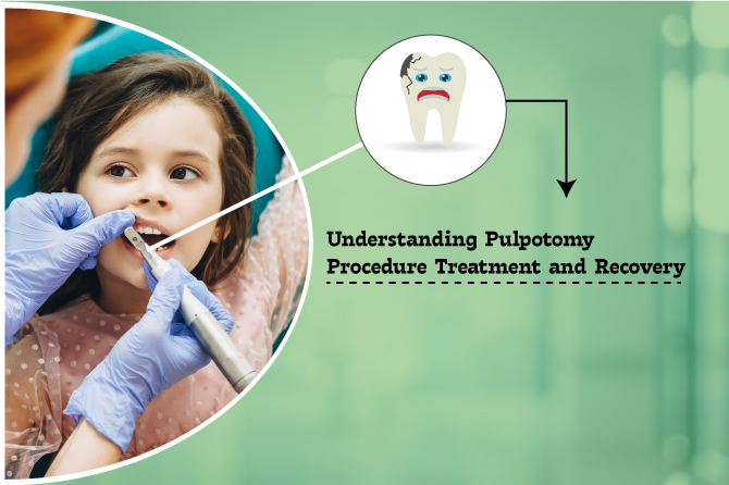 Understanding Pulpectomy: Saving Baby Teeth from Decay and Infection