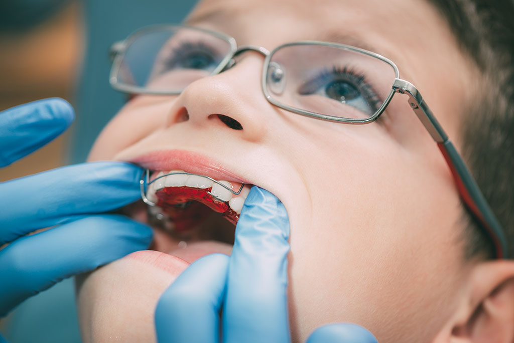 Early Interventions: A Comprehensive Guide to Interceptive Orthodontics