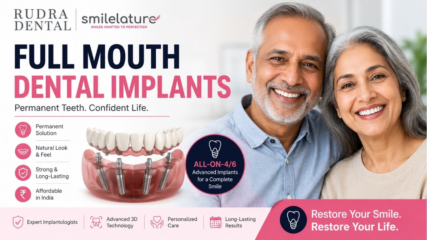 Full Mouth Dental Implants and how much do they Cost in India