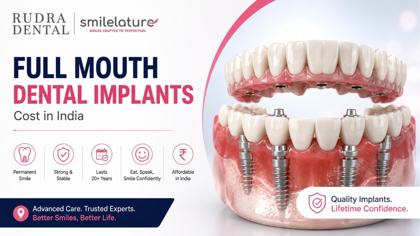 How Much Does a Full Mouth Dental Implant Cost in India?